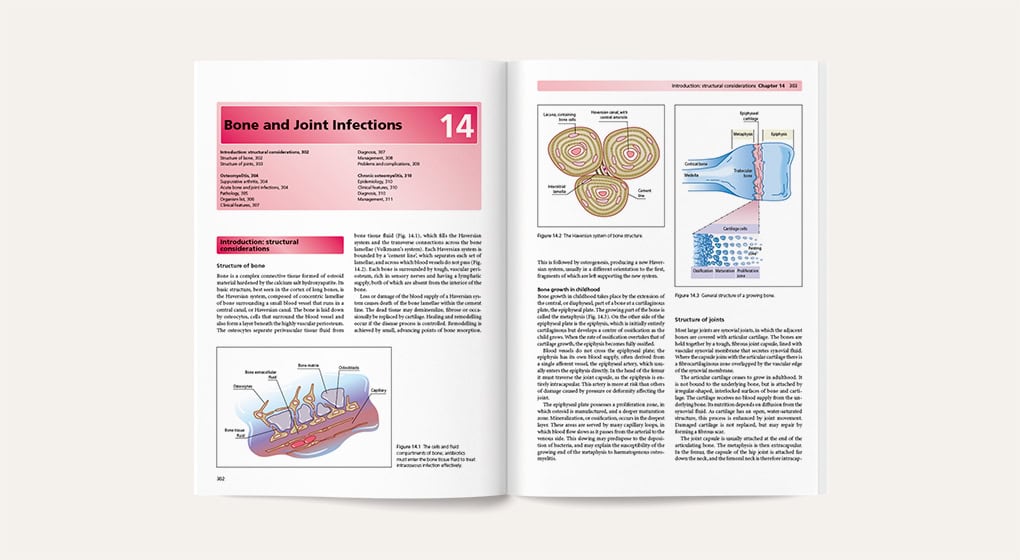 Infection - sample page