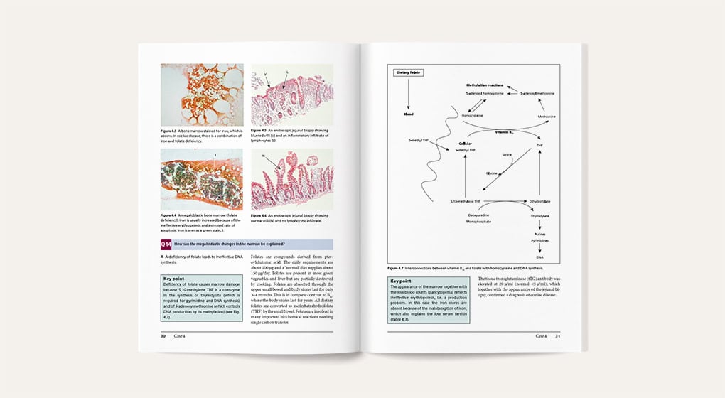 Case-Based Haematology - sample page